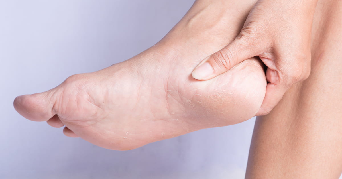 Fast and Easy Care to Remove Cracked Heels & Foot Dead Skin Cells 