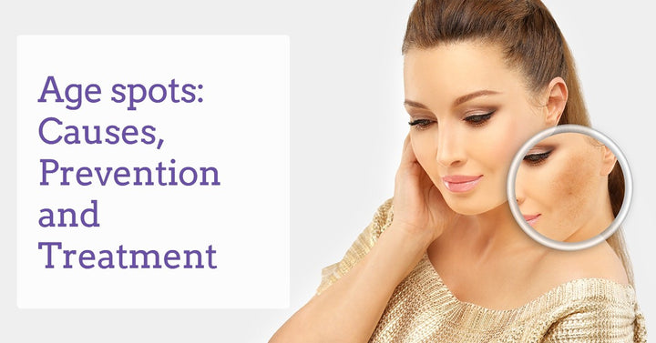 Age-spots-Causes-Prevention-&-Treatment-dermaessentia