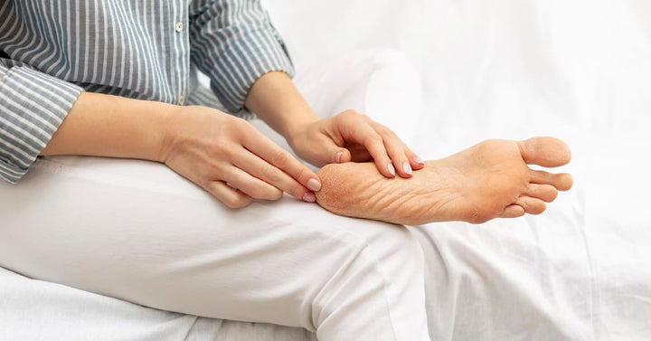 Natural remedies for cracked heels | Times of India