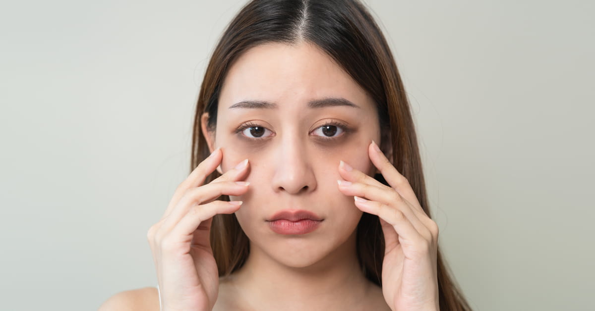 Amazing Ways to Remove Dark Circles That Work Wonders – Derma Essentia