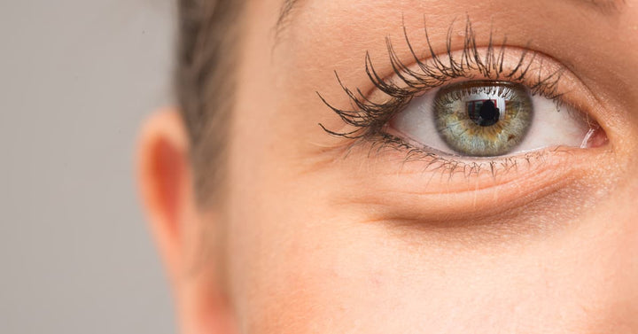Puffy Eyes, Dark Circles, and Bags: Dermatologists Explain the Difference