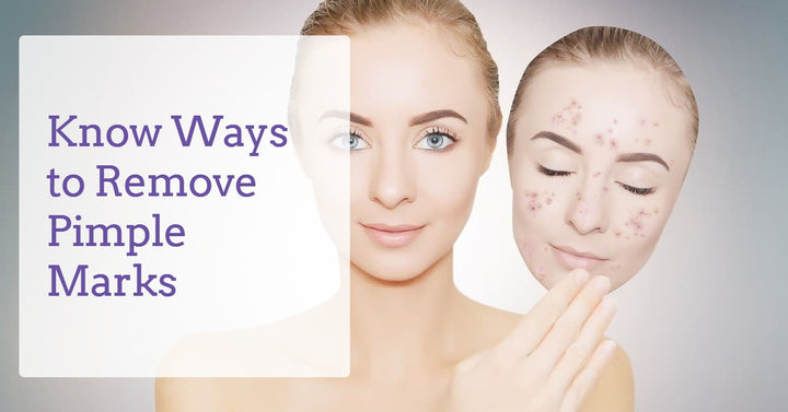 Ways-to-Remove-Pimple-Marks-derma