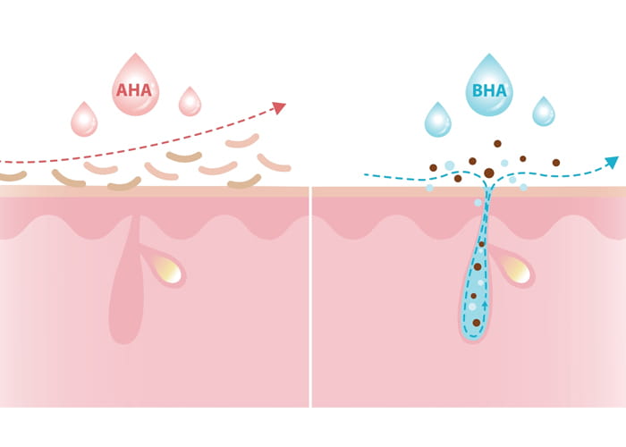 Comparing AHA And BHA
