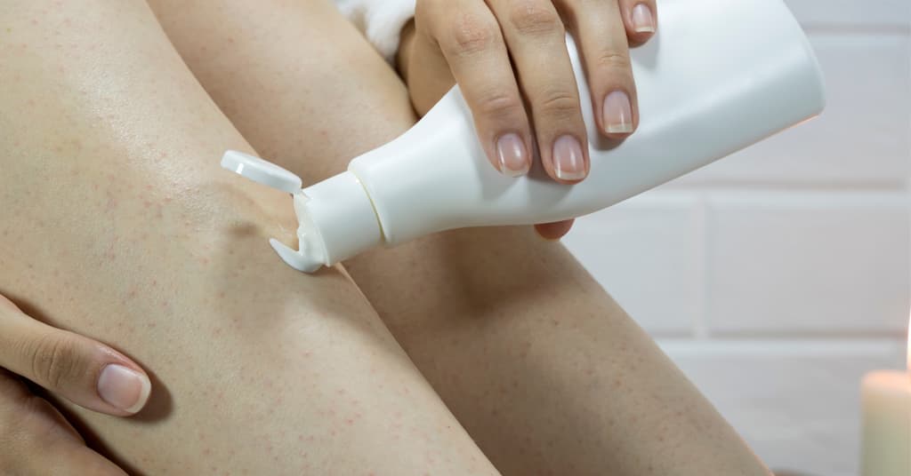 What are Strawberry Legs and How to reduce them