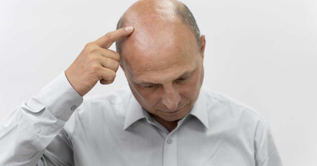 Male pattern baldness