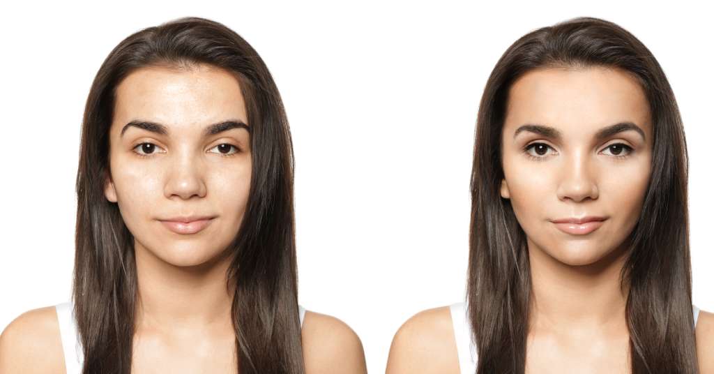 Benefits of Zinc for Skin and Hair