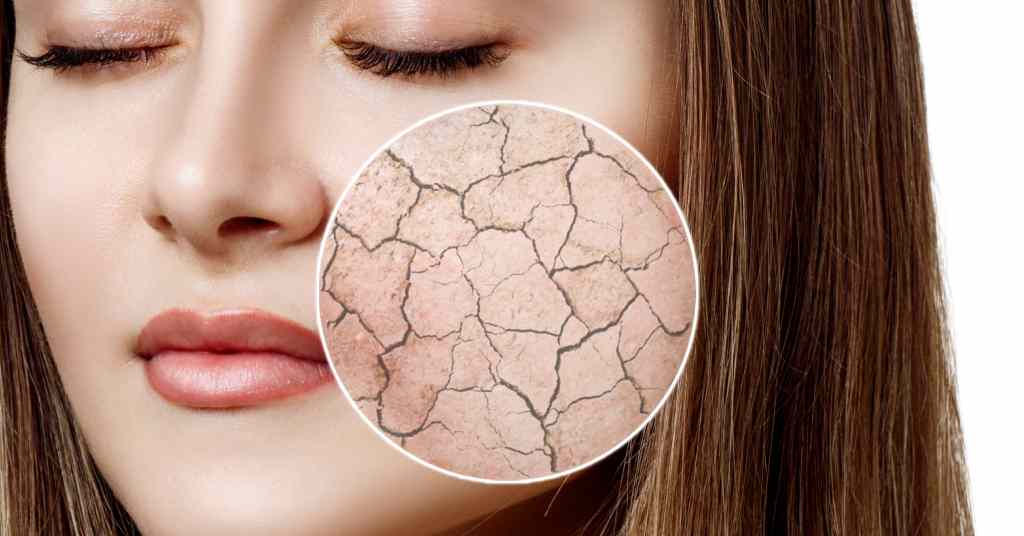 damaged skin barrier