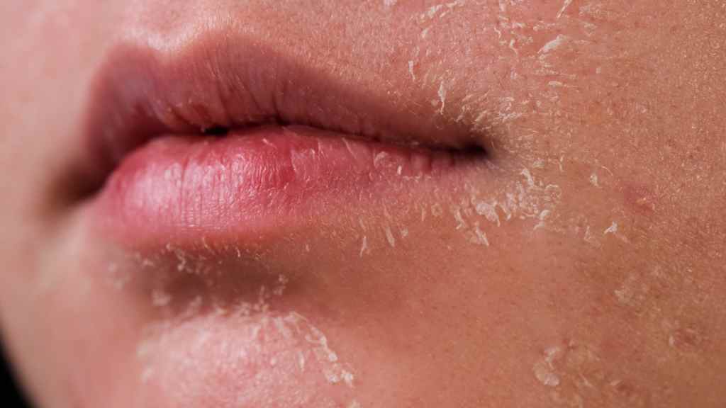 take care of dry skin