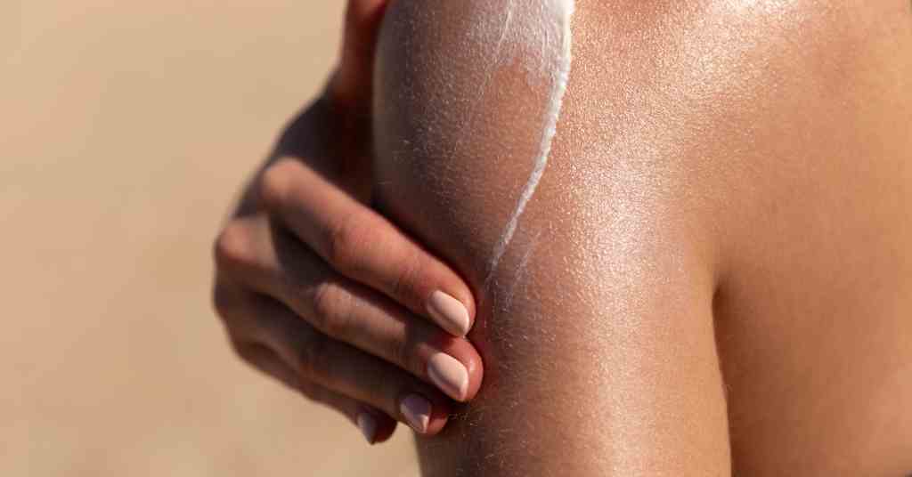 How to treat sunburn