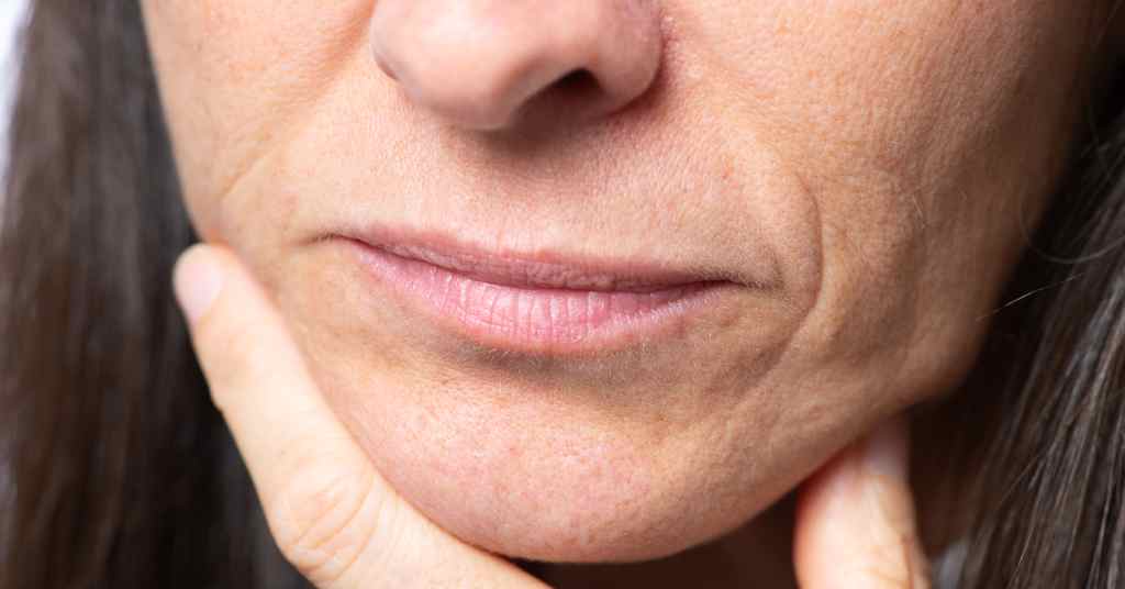 cure dry skin on face